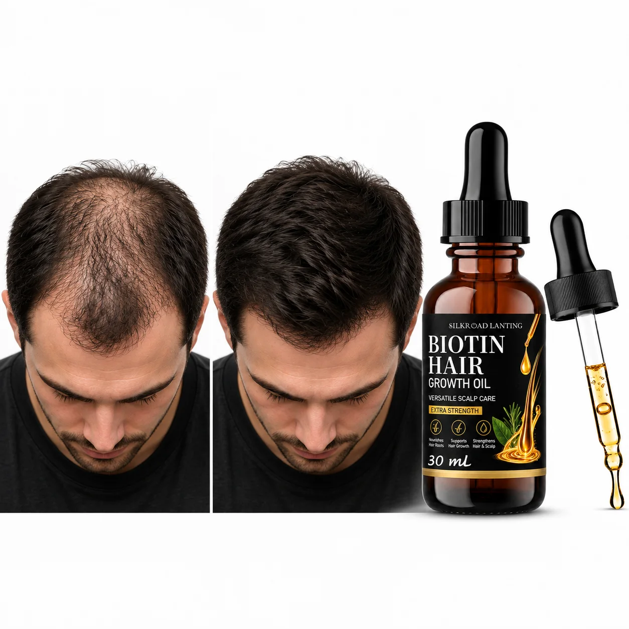 Biotin Hair & Scalp Oil