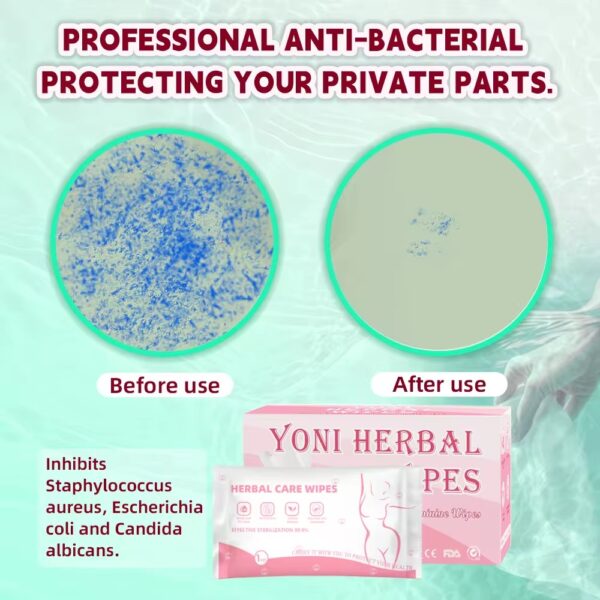Yoni Wipes - Image 3